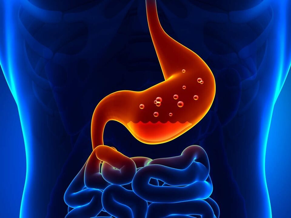 A gastrite é unha enfermidade inflamatoria do estómago que require unha dieta